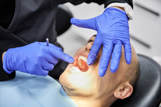 Best Emergency Dental Care for Sports Injuries in Citrus Park, AZ